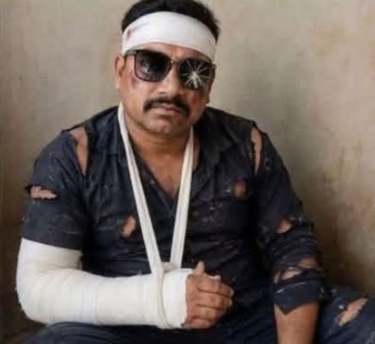 जीजा काजू वाली बर्फी नहीं लाया तो साले ने की पिटाई हताश जीजा हुआ जख्मी।